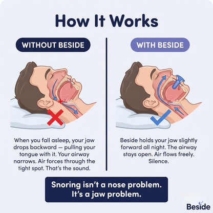Beside™ Anti-Snoring Mouthpiece